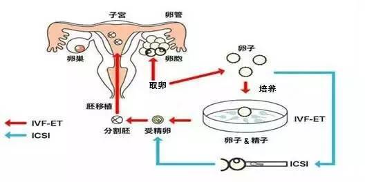 人工授精